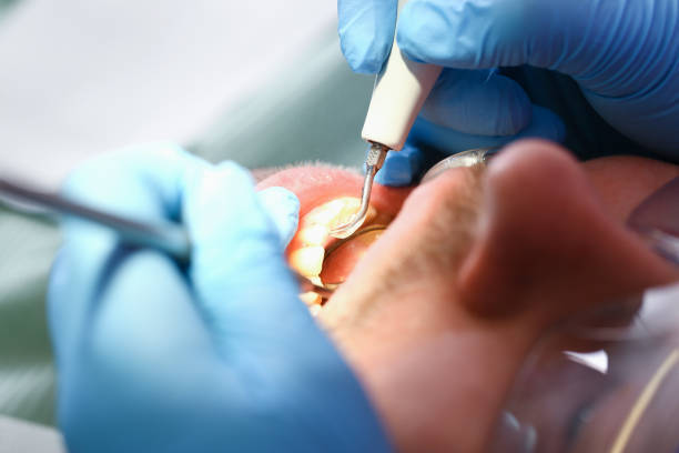 Best Emergency Treatment for Toothache in Los Banos, CA